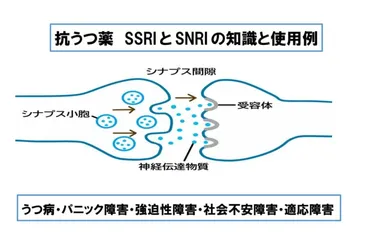 抗うつ薬・・・