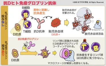 式血液型不適合妊娠にどうして抗ヒト免疫グロブリンを投与するの?│見えてくる産婦人科学オブギネ学校
