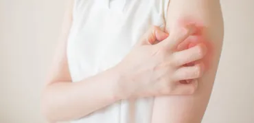 蕁麻疹のスピリチュアルな意味とは？心と体の声に耳を傾ける方法とは？体のサインを見逃さない！蕁麻疹が示すスピリチュアルなメッセージ
