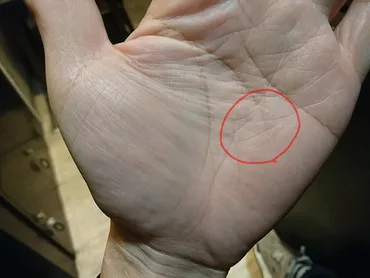 手相に五芒星（ソロモンの星）があった！ 