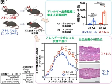 精神的ストレスがアトピー性皮膚炎を悪化させるメカニズムを解明