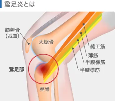 膝の痛み？心の声を聞く、原因とスピリチュアルな解決法とは？膝の痛みのスピリチュアルな原因と、あなたに必要な癒し