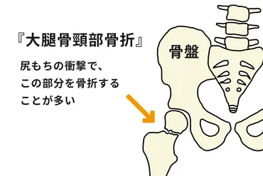 転倒予防のためにすぐできること。介護のプロが教える高齢者転倒の原因と対策